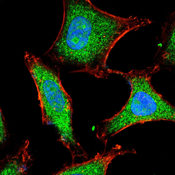 PPM1A Antibody