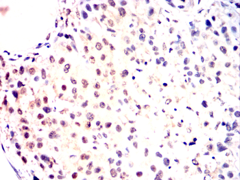 PPM1A Antibody