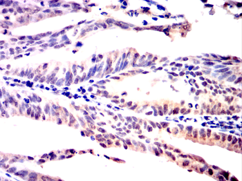 PPM1A Antibody