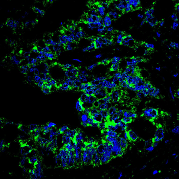 PPM1A Antibody