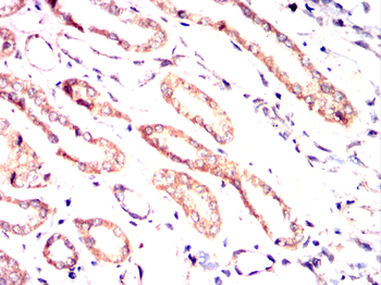 PPM1A Antibody