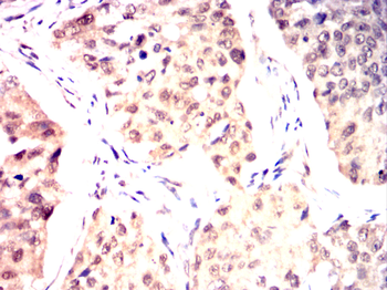 PPM1A Antibody