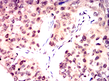 ARHGDIA Antibody
