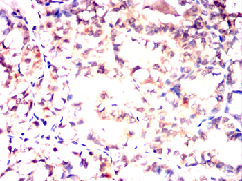 ARHGDIA Antibody