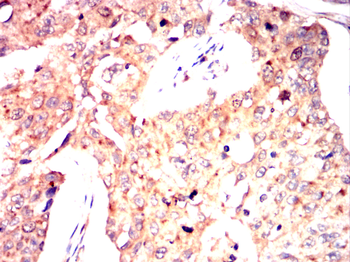 INCENP Antibody