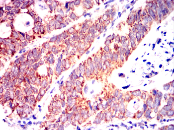 INCENP Antibody