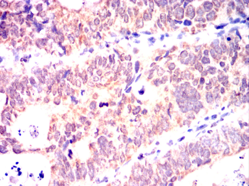 SPIB Antibody