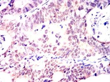 CSNK2A2 Antibody
