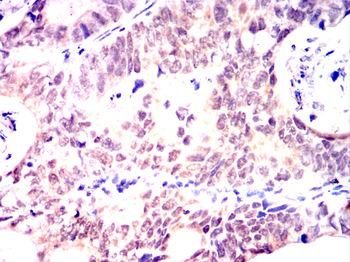 CSNK2A2 Antibody