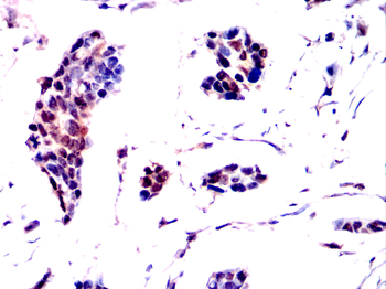 CSNK2A2 Antibody