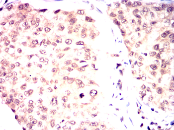 CSNK2A2 Antibody