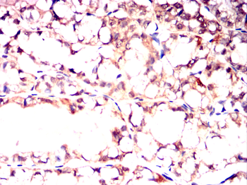CSNK2A2 Antibody