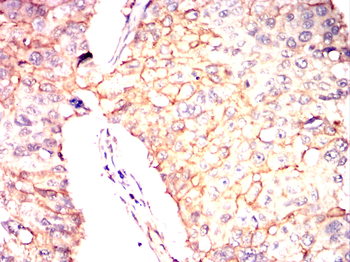ANXA1 Antibody