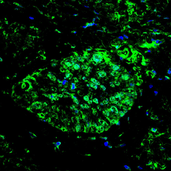 FOXP1 Antibody