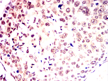 FOXP1 Antibody
