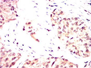 FOXP1 Antibody