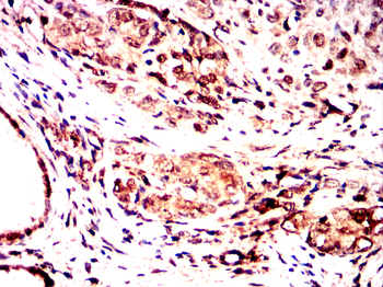MARK3 Antibody