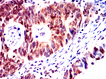 MARK3 Antibody