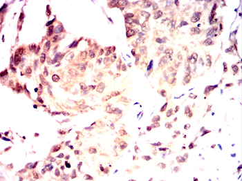 MARK3 Antibody