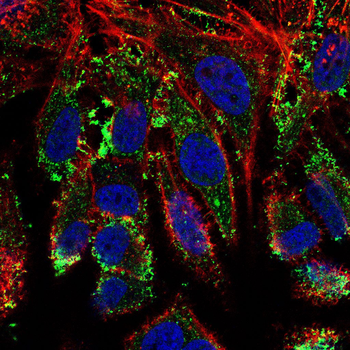 SLC27A5 Antibody