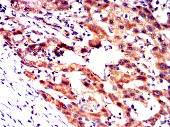 SLC27A5 Antibody