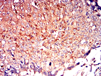 SLC27A5 Antibody