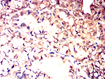 SLC27A5 Antibody