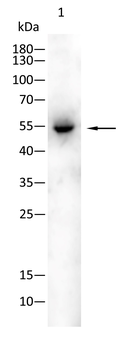 SLC27A5 Antibody