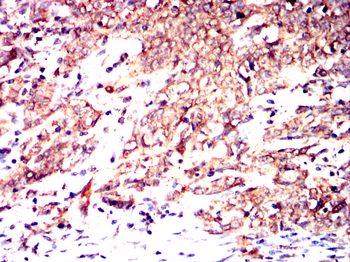 PDE1B Antibody