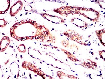 PDE1B Antibody