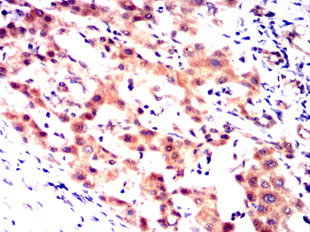 GUCY1A1 Antibody