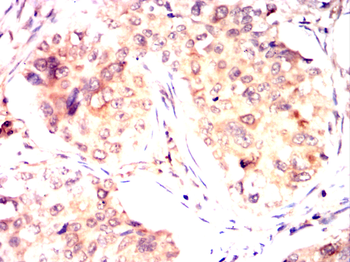 GUCY1A1 Antibody
