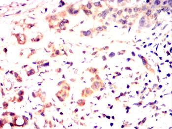 ITGB4 Antibody