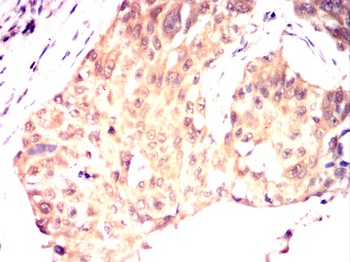 ITGB4 Antibody