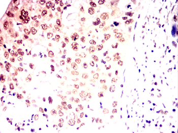 PAX3 Antibody