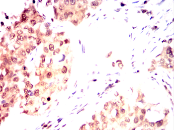 PAX3 Antibody