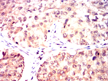 MRPL42 Antibody