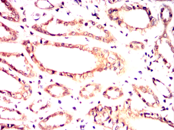 TUBB2A Antibody
