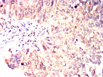 TUBB2A Antibody