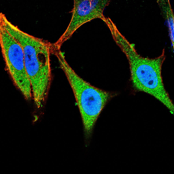 BRCA1 Antibody