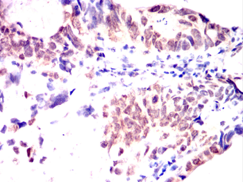 BRCA1 Antibody