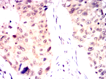 BRCA1 Antibody