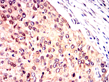 BRCA1 Antibody