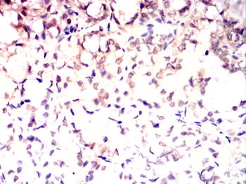 BRCA1 Antibody