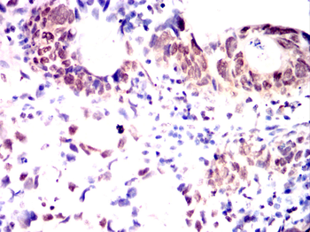 GSC Antibody