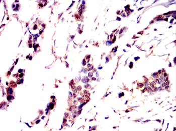 GSC Antibody