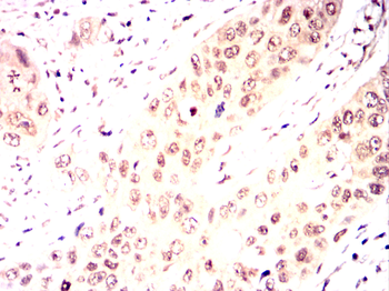GSC Antibody