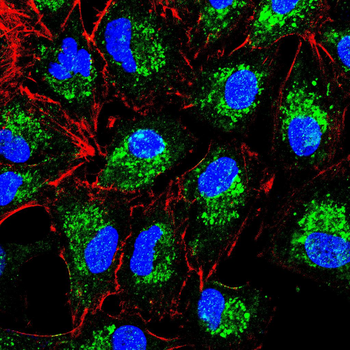 IL1B Antibody