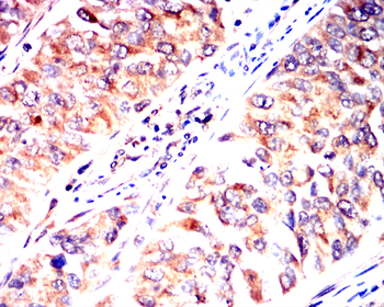 IL1B Antibody