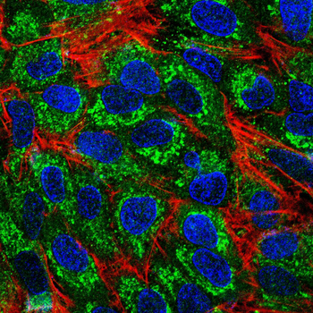 PIK3R1 Antibody